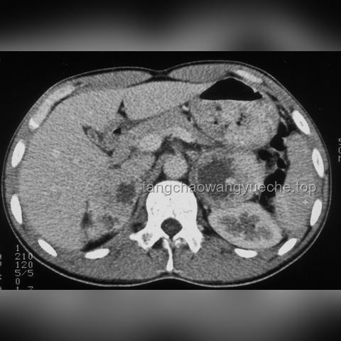 甲状腺健康3大积极表现对比分析